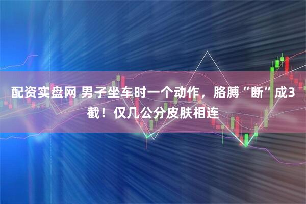 配资实盘网 男子坐车时一个动作，胳膊“断”成3截！仅几公分皮肤相连